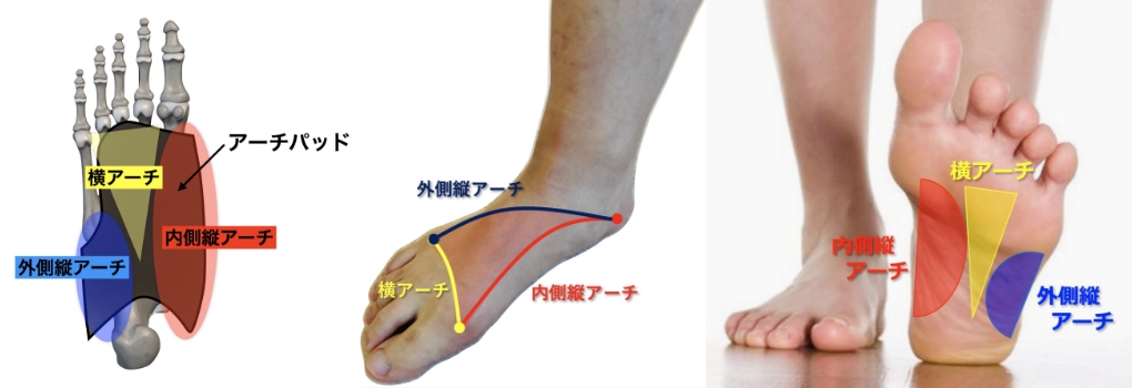 インソール療法