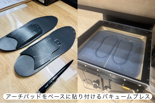 インソール療法